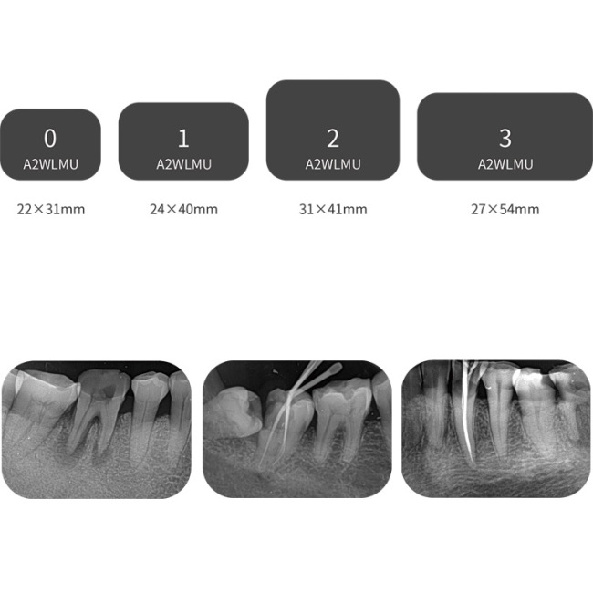 Digitized Intraoral Image Plate Dental Scanner